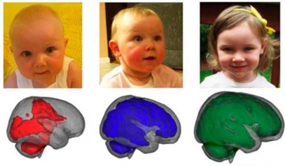 Babyers forskillige hjerner