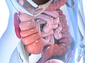 De to tamsygdomme, Crohns og colitis ulcerosa ser ud til at blive påvirket negativt af mavefedt.